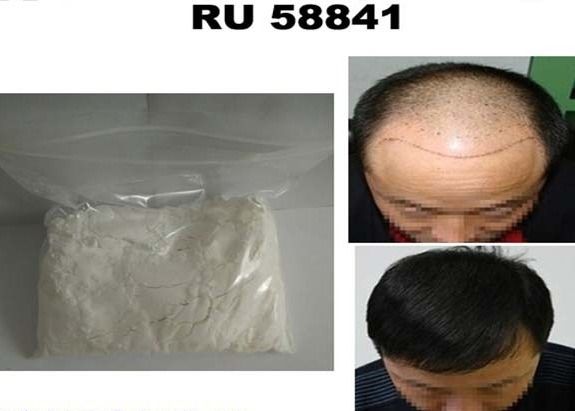 Anti Androgens Anabolic Steroid Powder CAS 154992-24-2 RU-58841 Treating Hair Loss